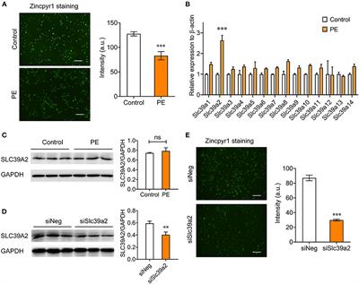 Slc39a2-Mediated Zinc Homeostasis Modulates Innate Immune Signaling in Phenylephrine-Induced Cardiomyocyte Hypertrophy